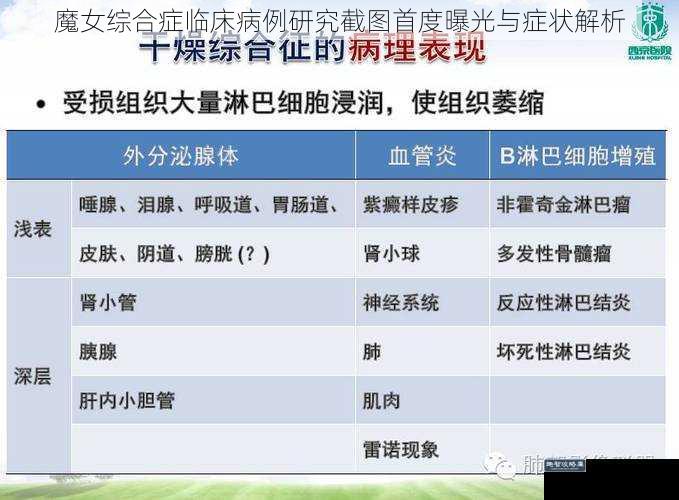 魔女综合症临床病例研究截图首度曝光与症状解析